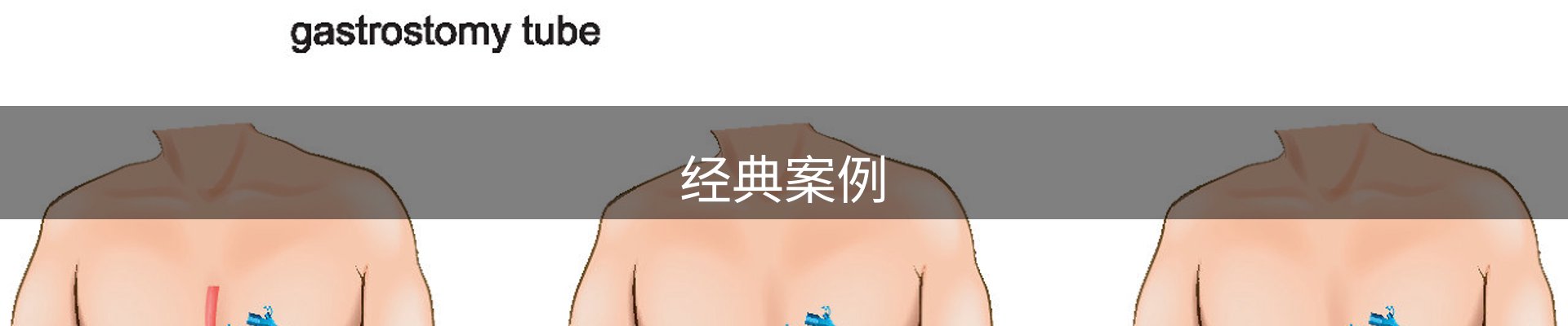 经典案例